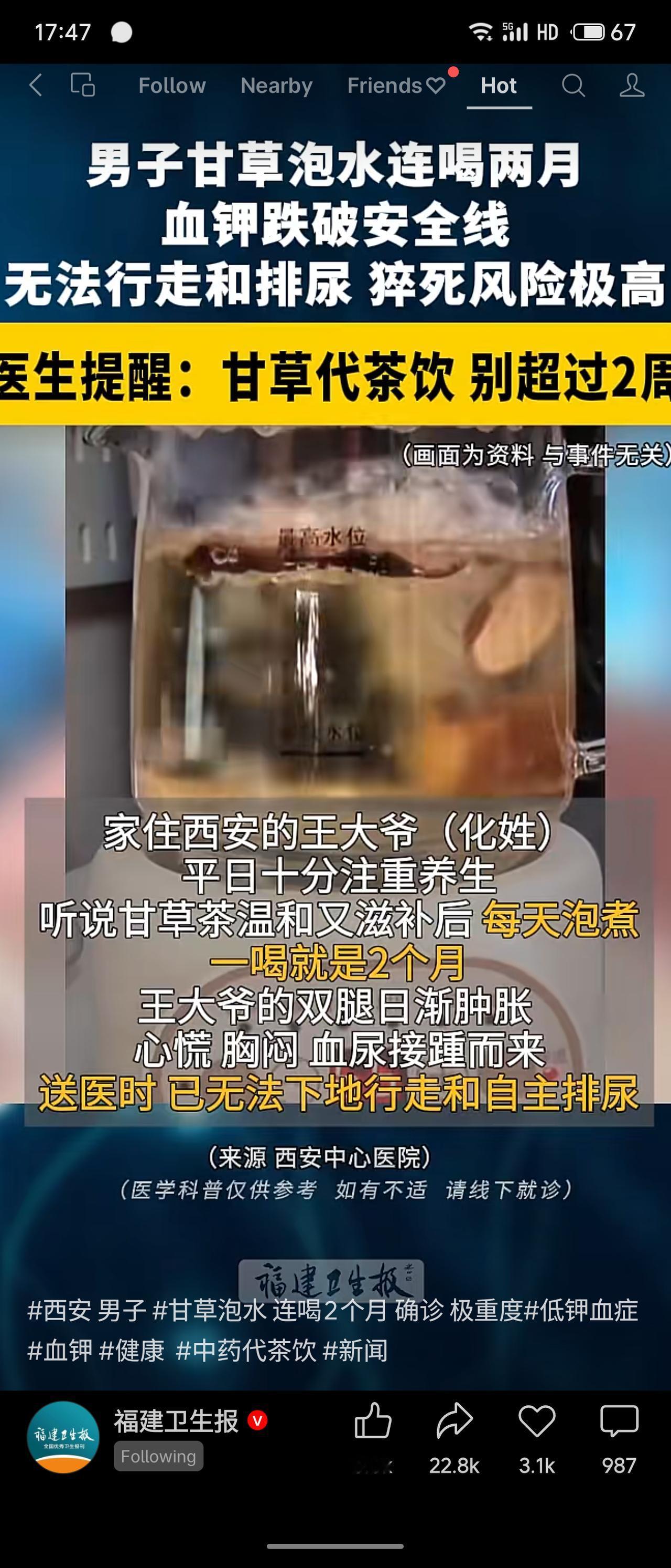 西安王大爷养生听信甘草茶温和滋补，连续泡饮两个月，导致极重度低钾血症，双腿肿胀、