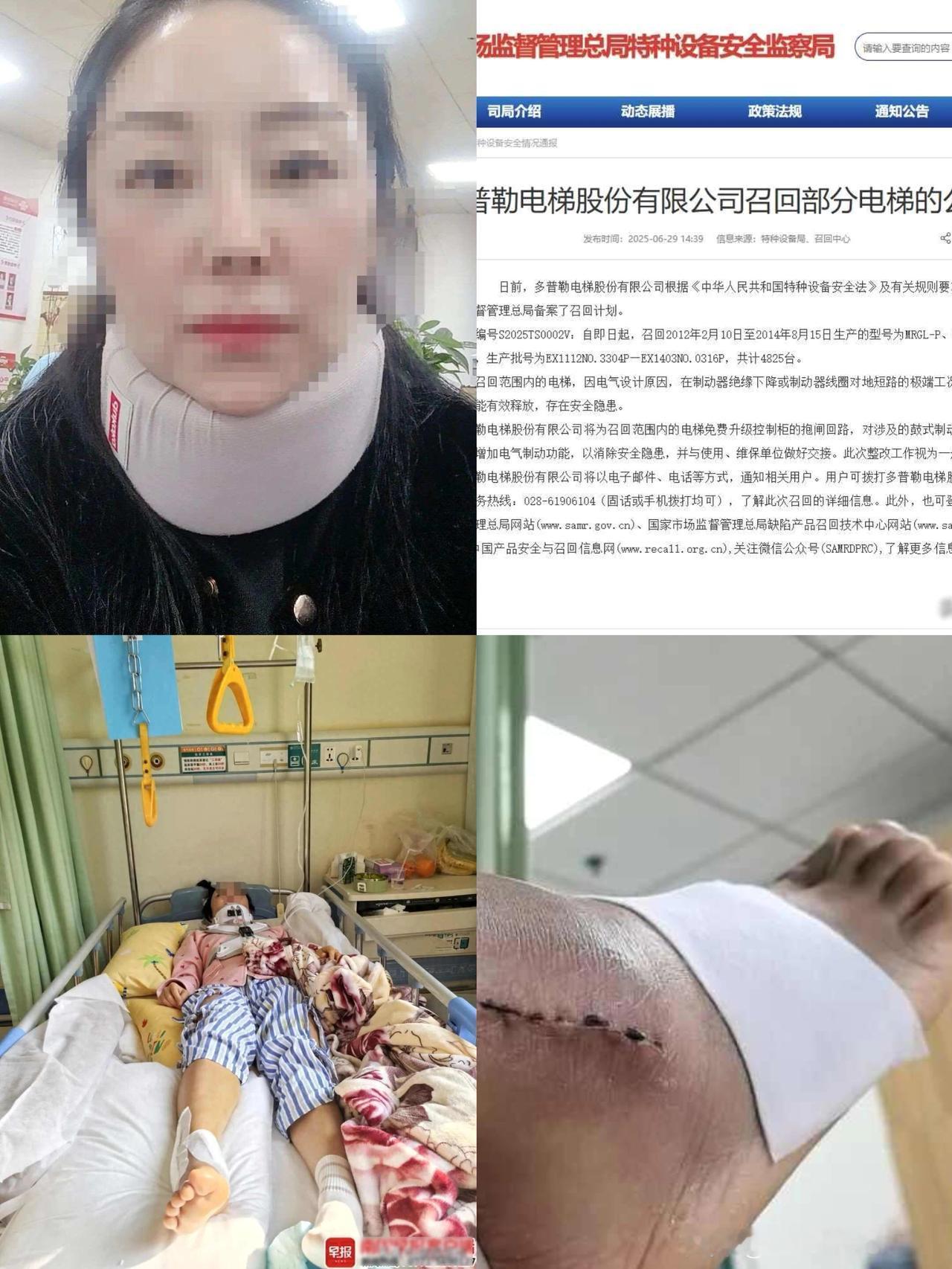 贵州兴义一小区电梯突然从4楼冲顶至28楼，
一女子被震飞受重伤，住院10个月，