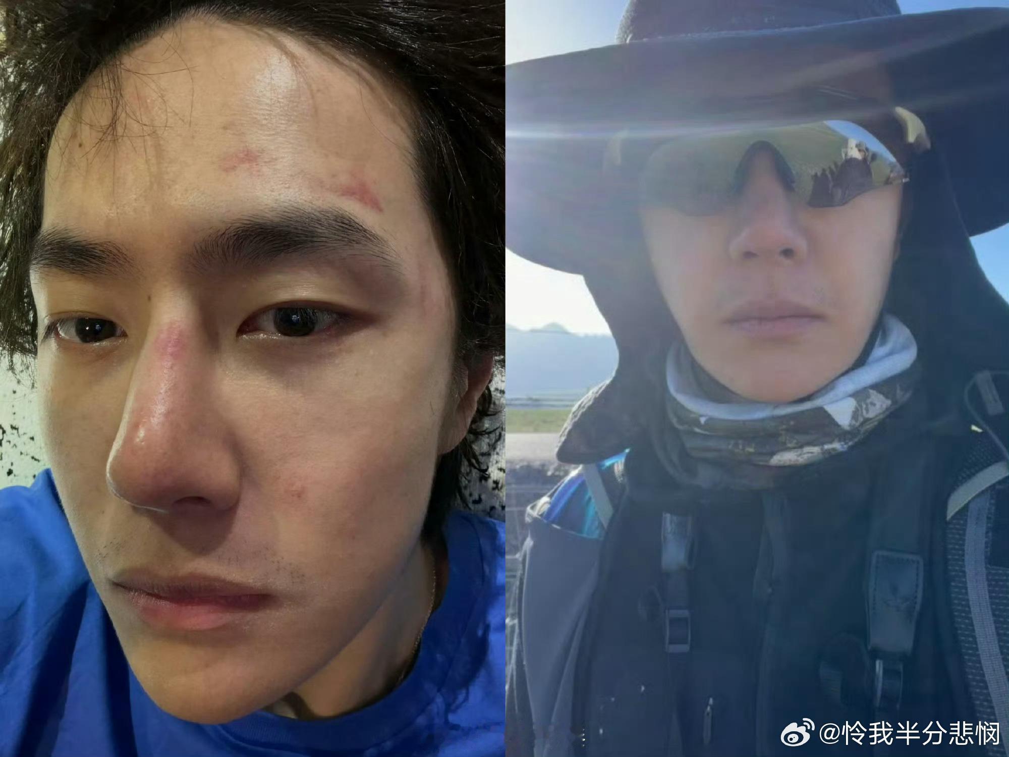 王一博ins素颜自拍王一博ins放出无滤镜素颜怼脸自拍，记录户外运动后真实状态，