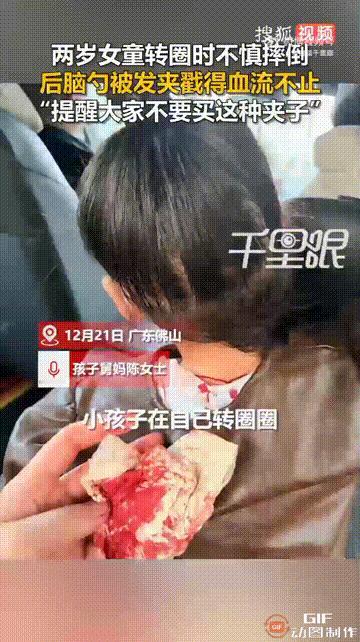 广东佛山一位妈妈给2岁女儿买了好看的发卡，女儿收到后非常喜欢，于是立马戴在头上，