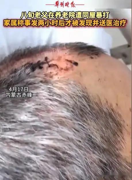 “必须严惩！”内蒙古赤峰，女子将丈夫送到养老院，几天后接丈夫，只见丈夫裤子直接裂