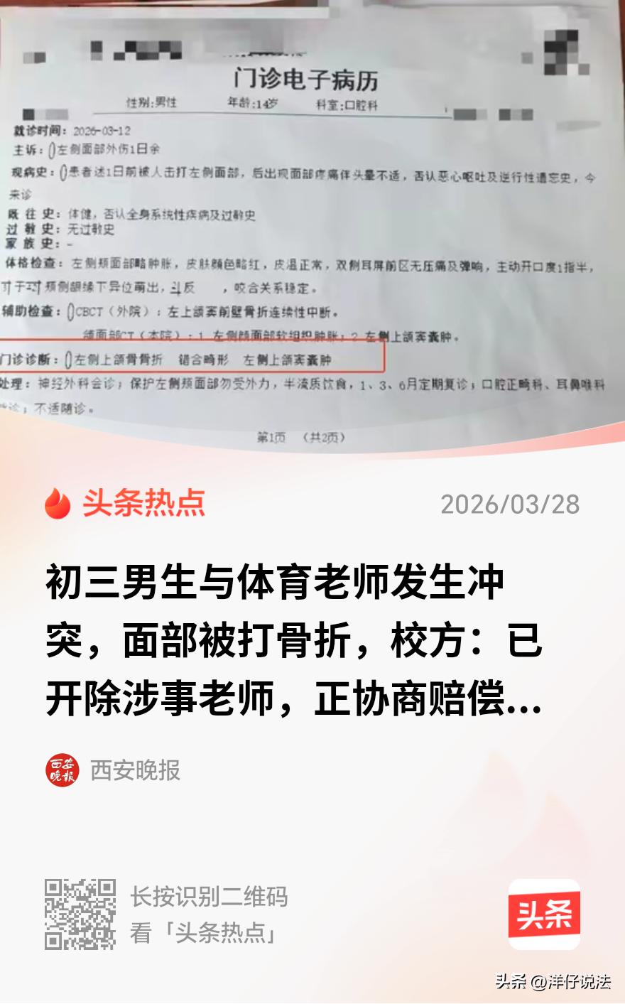 山西太原，一初三男生在体育课上和体育老师起了冲突。谁能想到，老师一拳打在了孩子脸