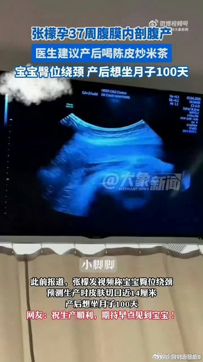 张檬孕37周腹膜内剖腹产看到张檬37岁生下娃娃真的太辛苦了啊，母爱真的是伟大无私