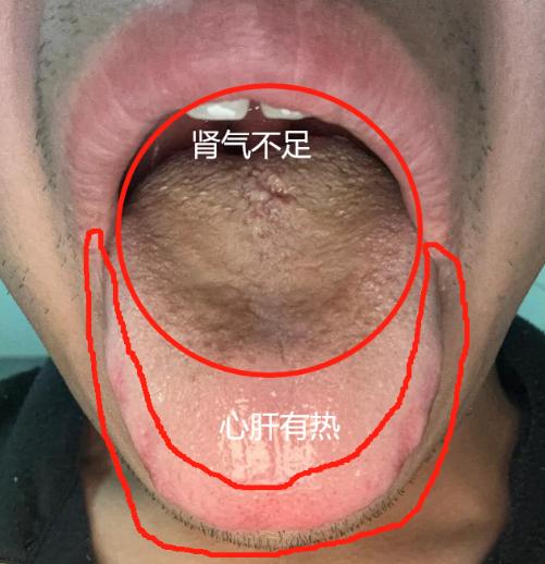 肾亏虚成这样的还真很少见到，我劝你赶紧停下，注意节制
患者说：那方面差劲的不行，