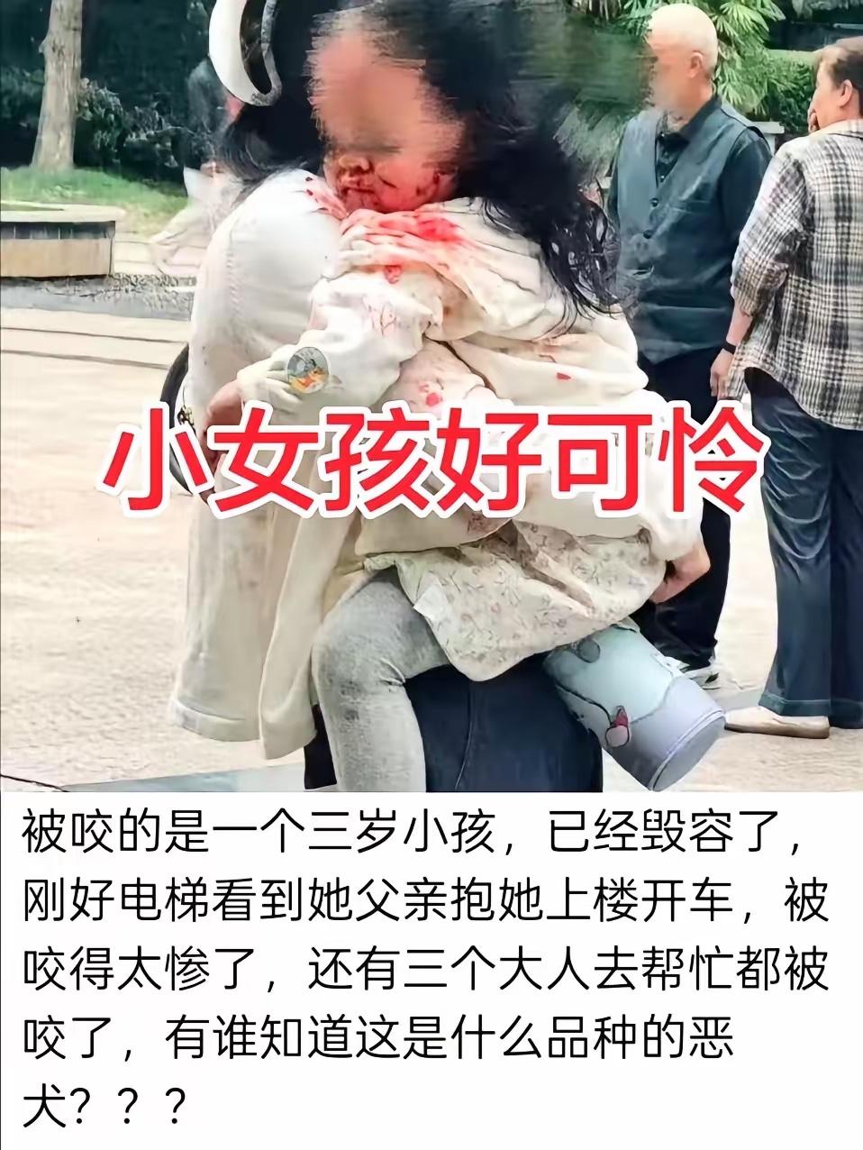 恶犬再闯大祸孩子受伤严重，女童被狗咬伤面部 狗主人已被刑拘，根据媒体报道：9月1
