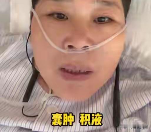 普通人的一夜暴红、暴富，这真的不是所有人都能够承受的。

比如这个脱口秀的房主任