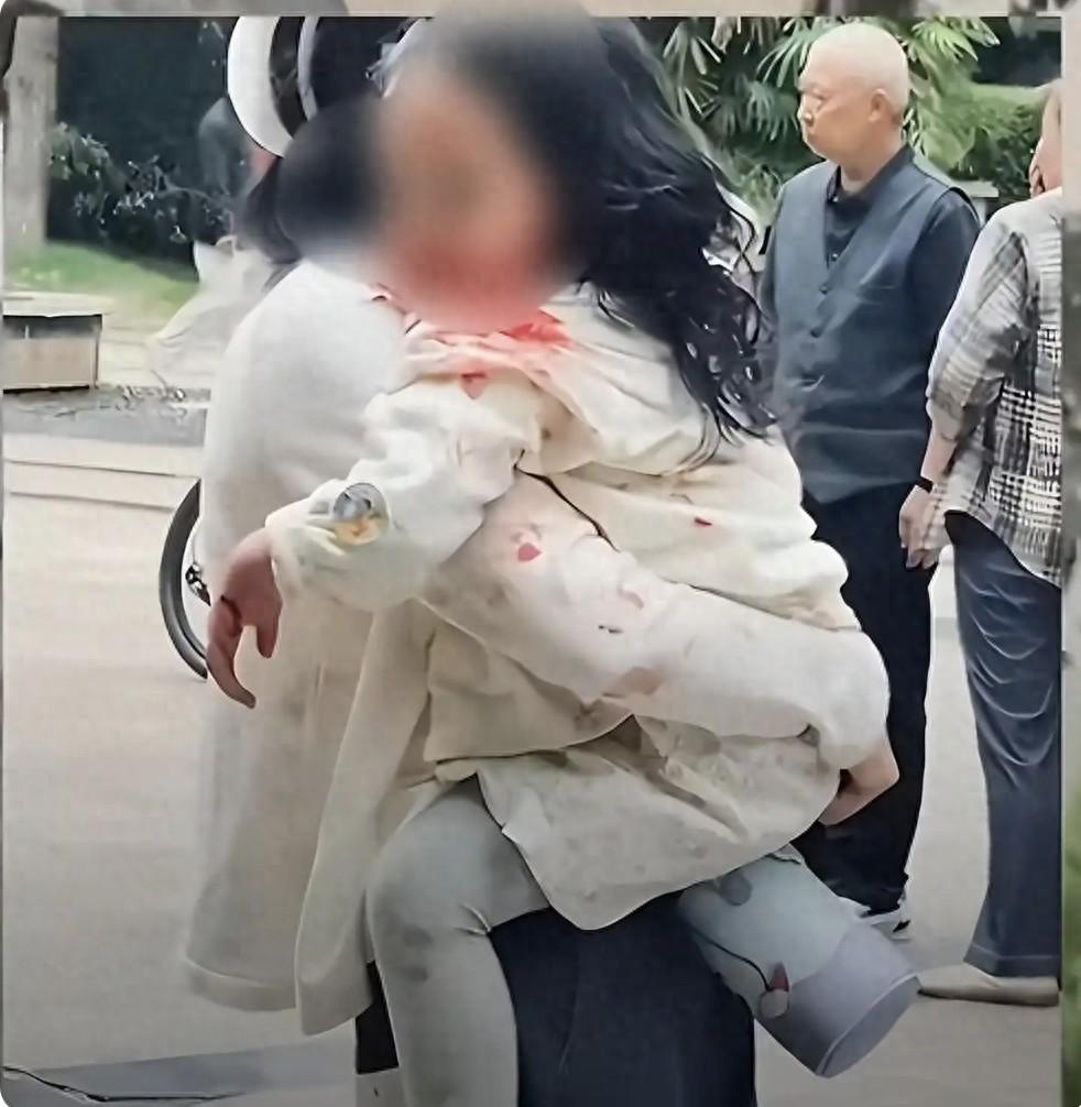 四川仁寿，一只没有牵绳的“牛头梗”烈性犬，在小区里失控，冲进人群中撕咬，导致5人