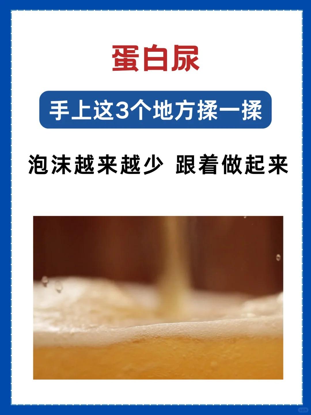 蛋白尿，手上3个地方揉一揉！