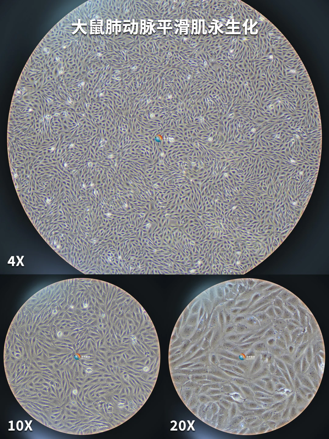 大鼠肺动脉平滑肌细胞永生化,有人养过吗