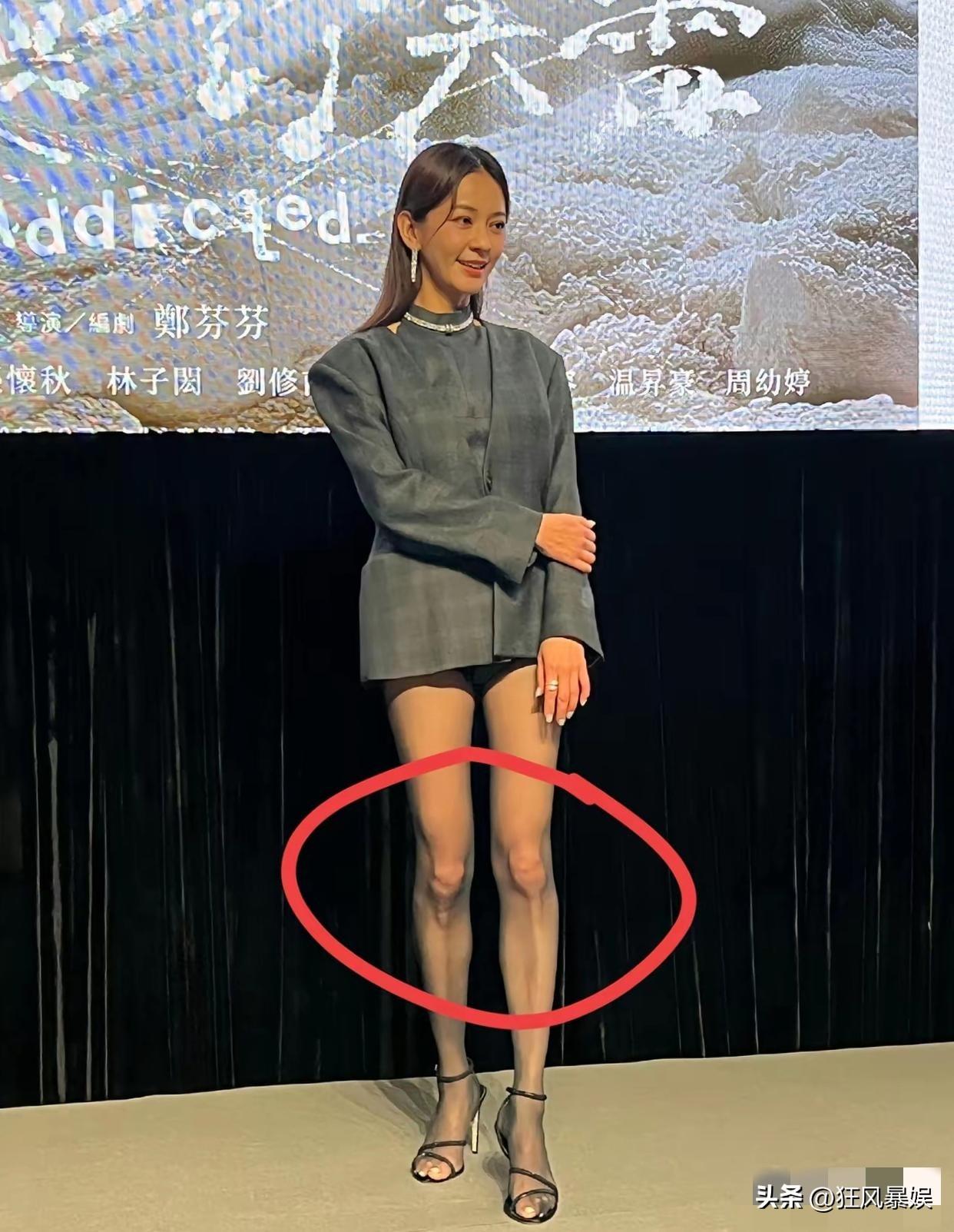 陈意涵，这腿是受损了吗？

陈意涵从2010年起，为疗愈失恋开始跑步，每天坚持跑