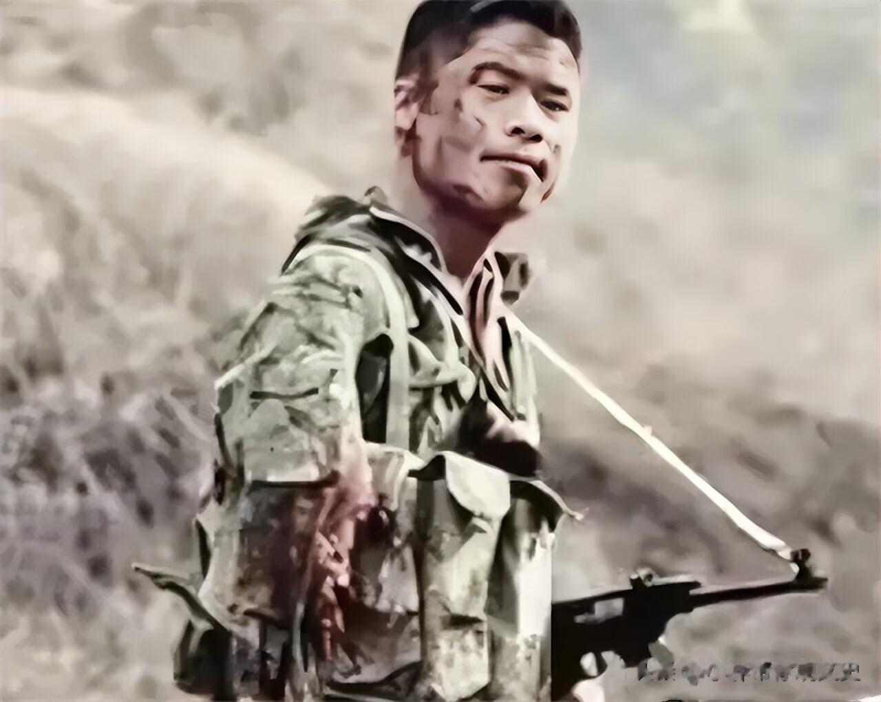1984年，刚刚从老山前线下来的战士，他的右臂肘部以下已经在战斗中炸没了，巨大的