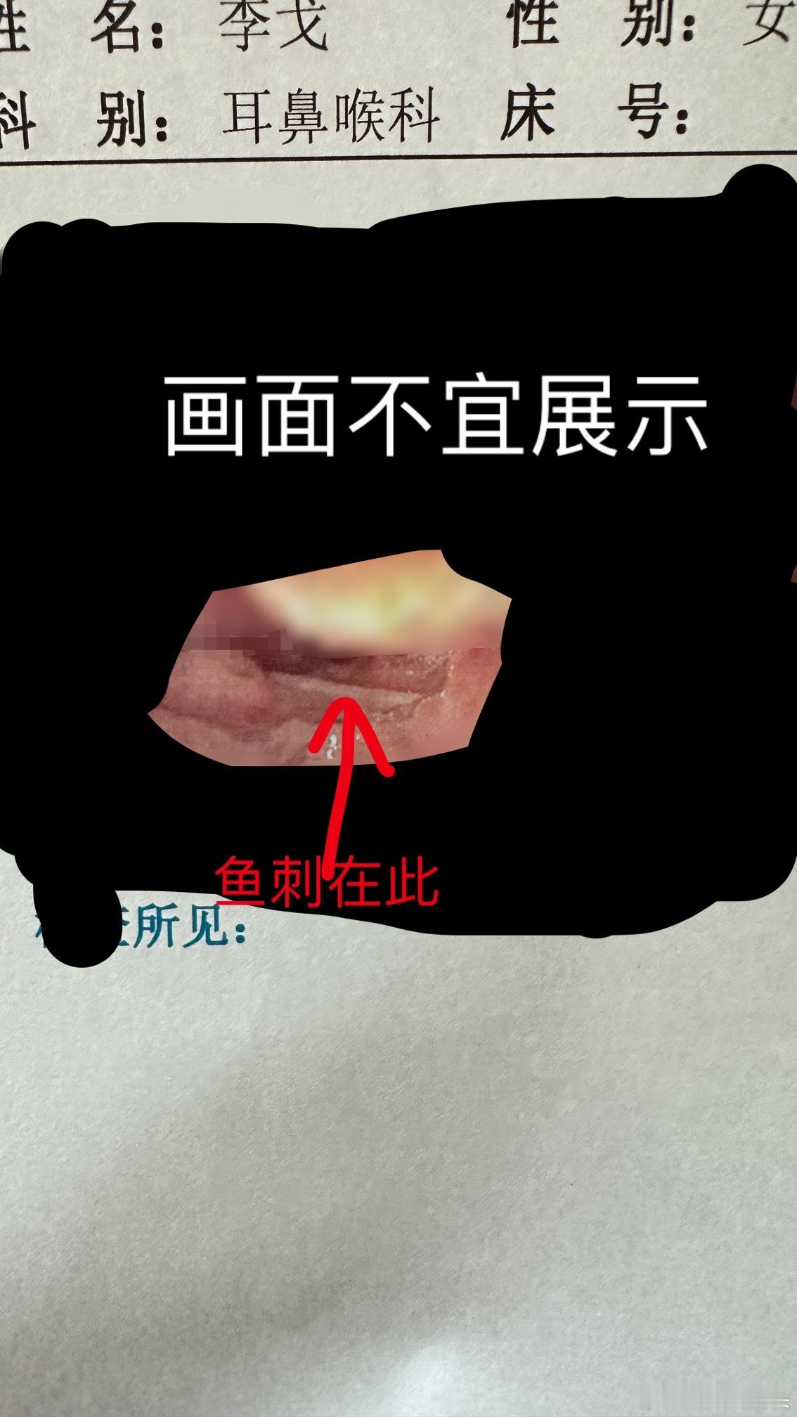 【卡鱼刺完整攻略】快过年了，在下恰好以身犯险，为各位整理了一份卡鱼刺完整攻略，转
