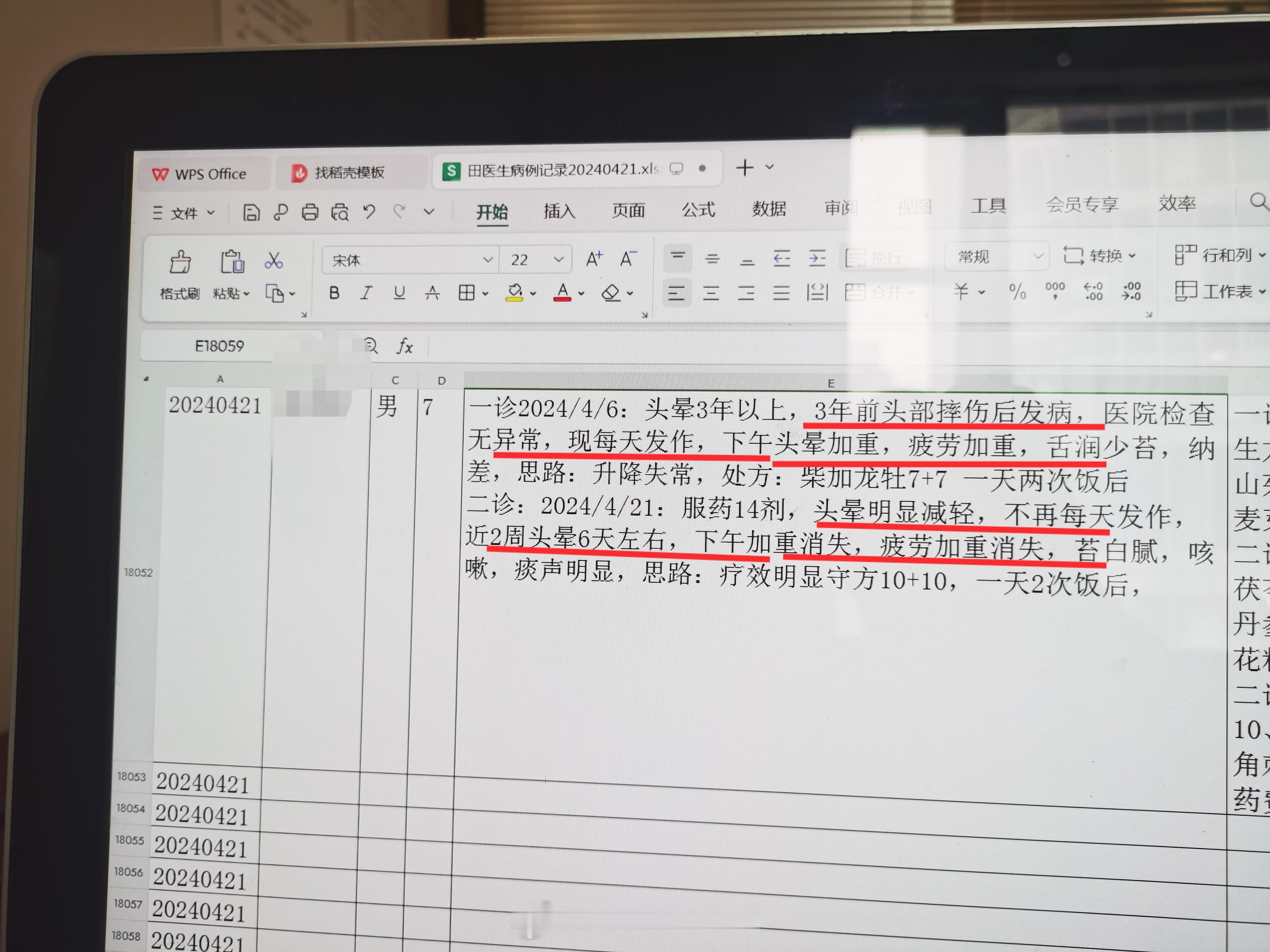 #中医##头晕# 头晕3年，摔伤头部后发病，就诊时每天头晕，下午、疲劳加重，从升
