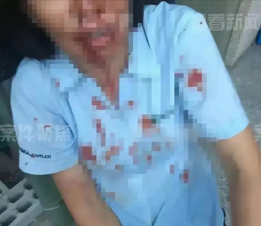 “亲戚上门变成打群架？舅妈泼腐蚀液体，把外甥烧成残疾，法院竟判她无罪！”

上海