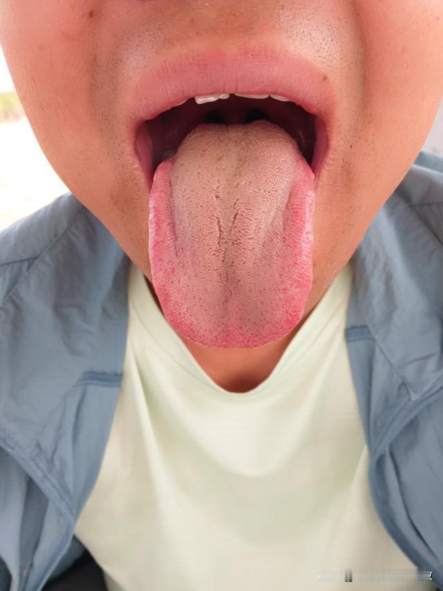 听我一句劝，一口辣的你也别吃了，再吃我怕你屁股疼的更厉害[打脸][打脸]

主诉