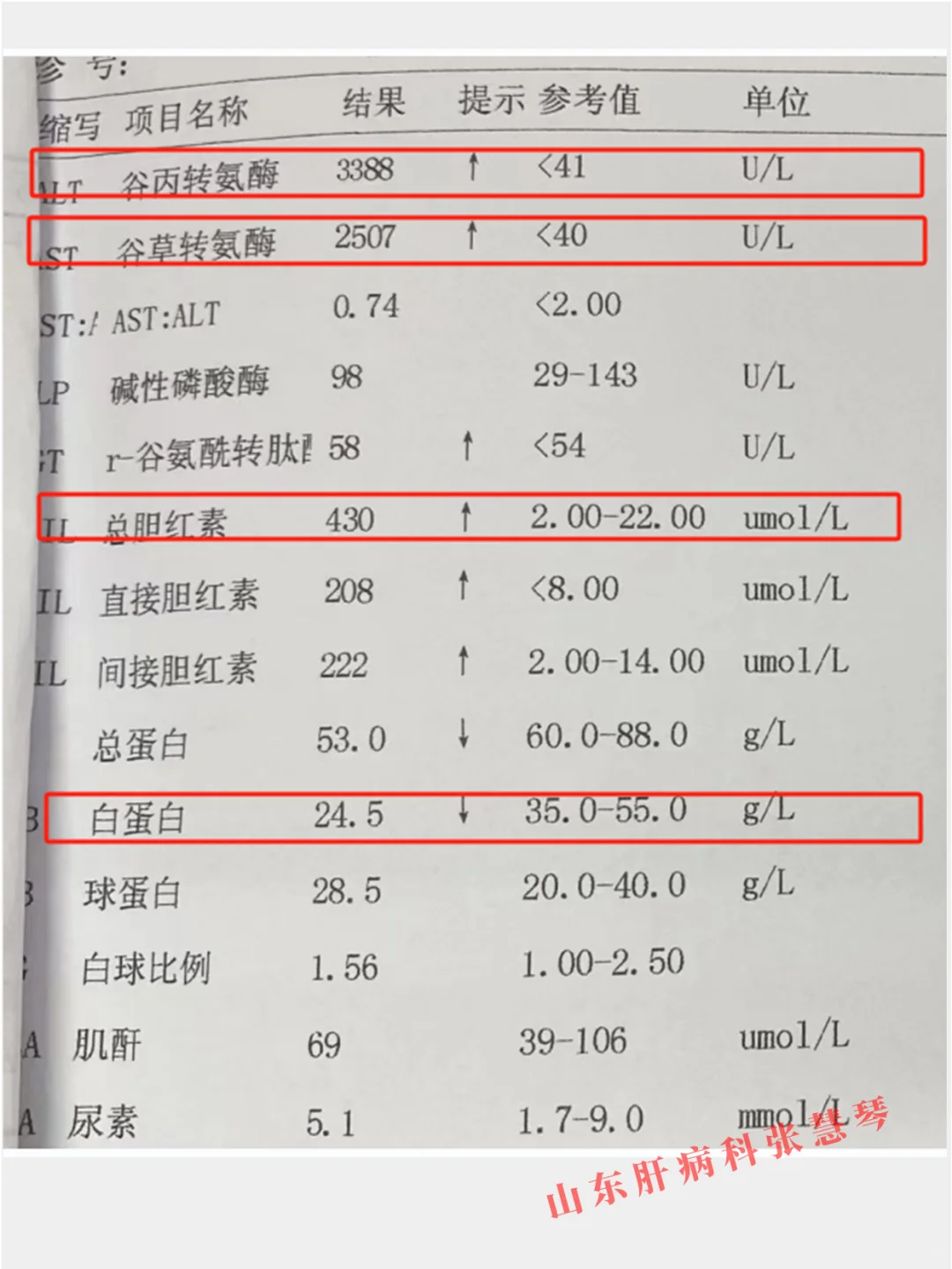 肝病医生，最不想看到这样的肝功能单子！