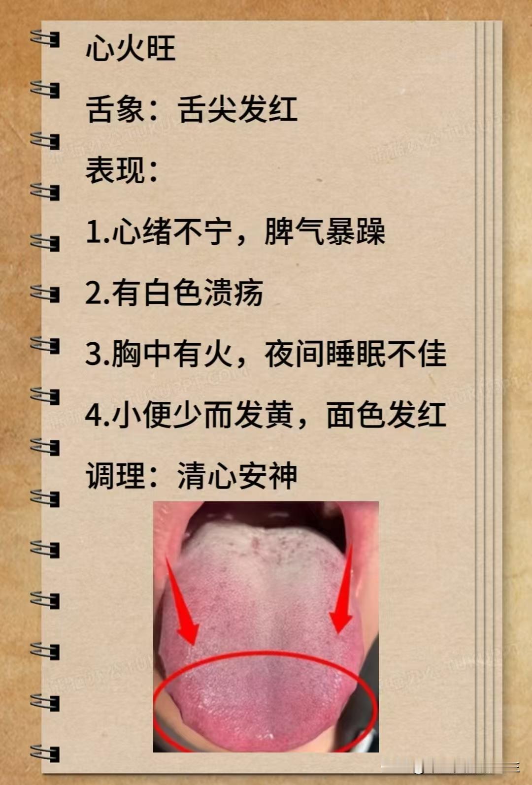 心火、肝火、胃火，中医教你对症灭火！
