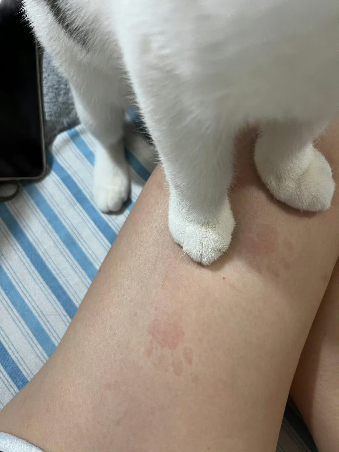 小猫变肥导致人类不堪重负  