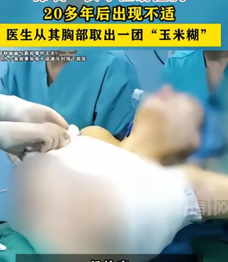 6月25号，深圳王女士因一直不舒服去医院。一查，原本打进去的透明凝胶竟变成黄白一