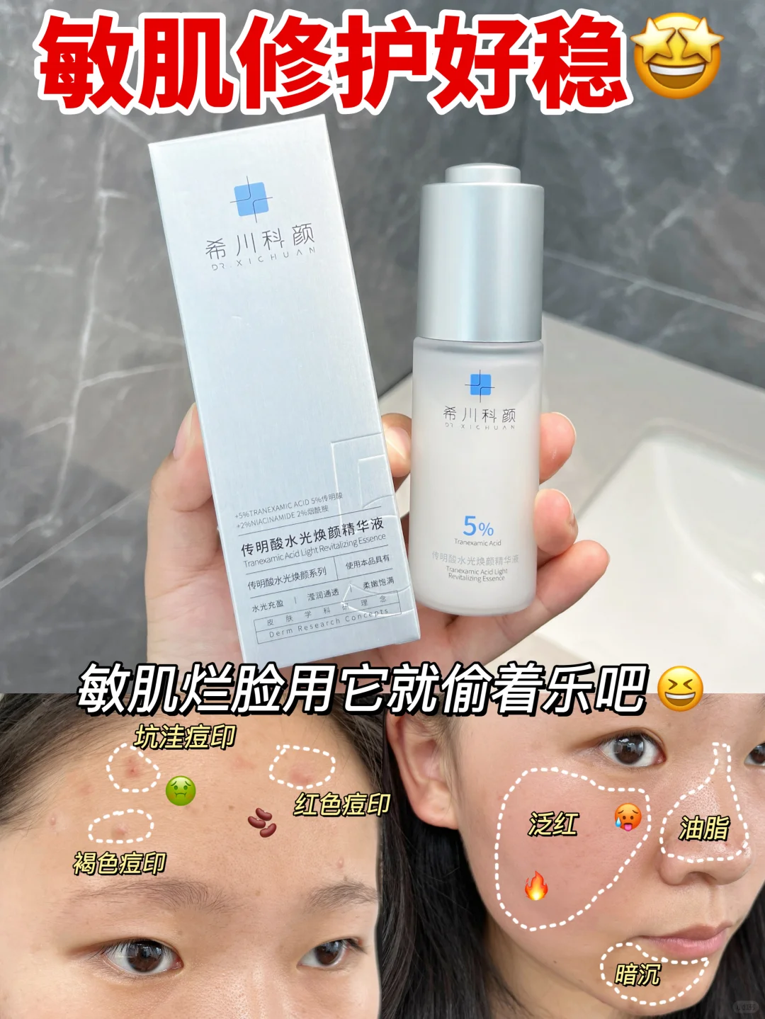 敏皮鲨疯了！用它红印子消消乐！全部退🤺🤺