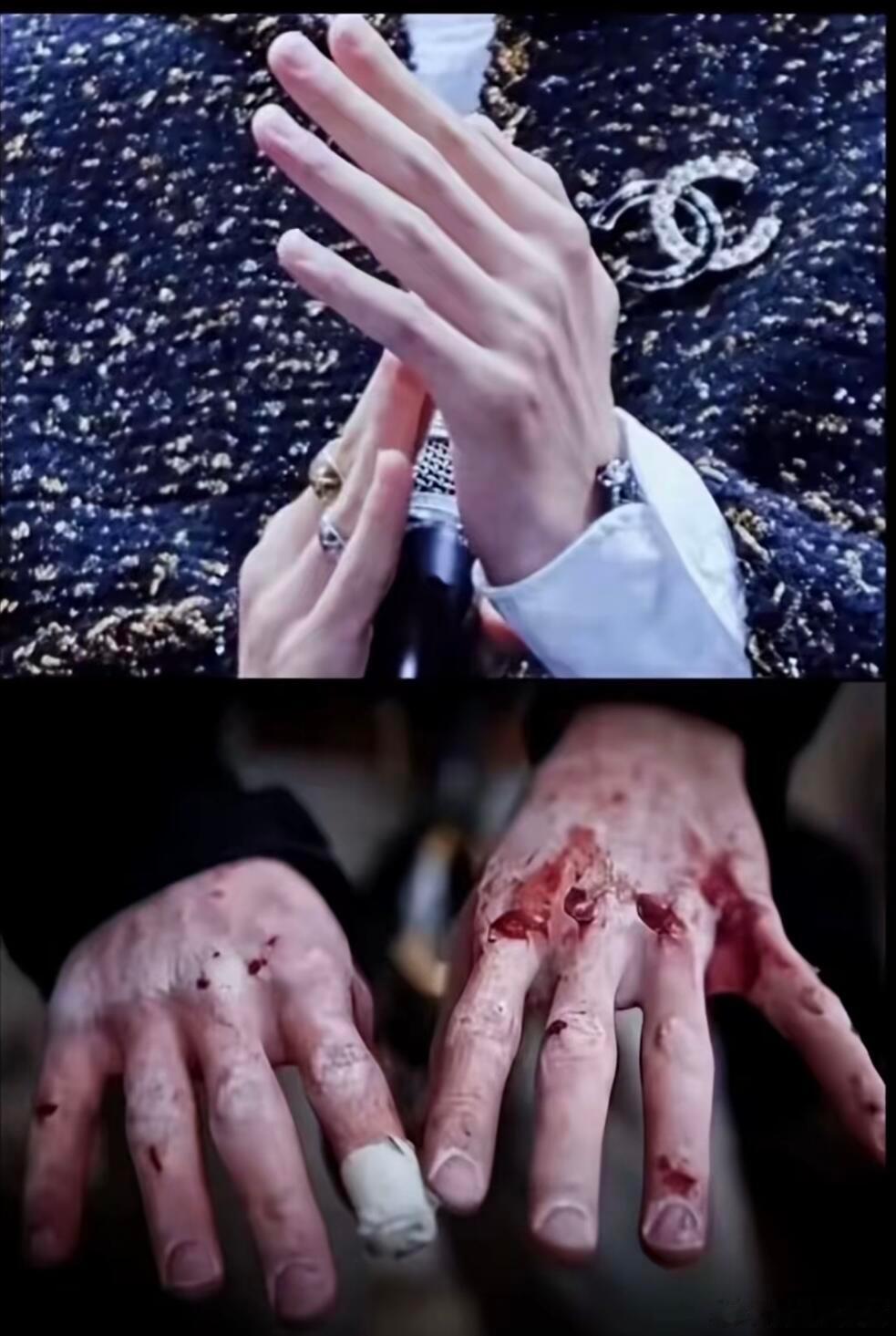王一博的手看着真让人心疼🥹一博自从徒手攀岩后手上就好多伤一博从不营销苦和难只是