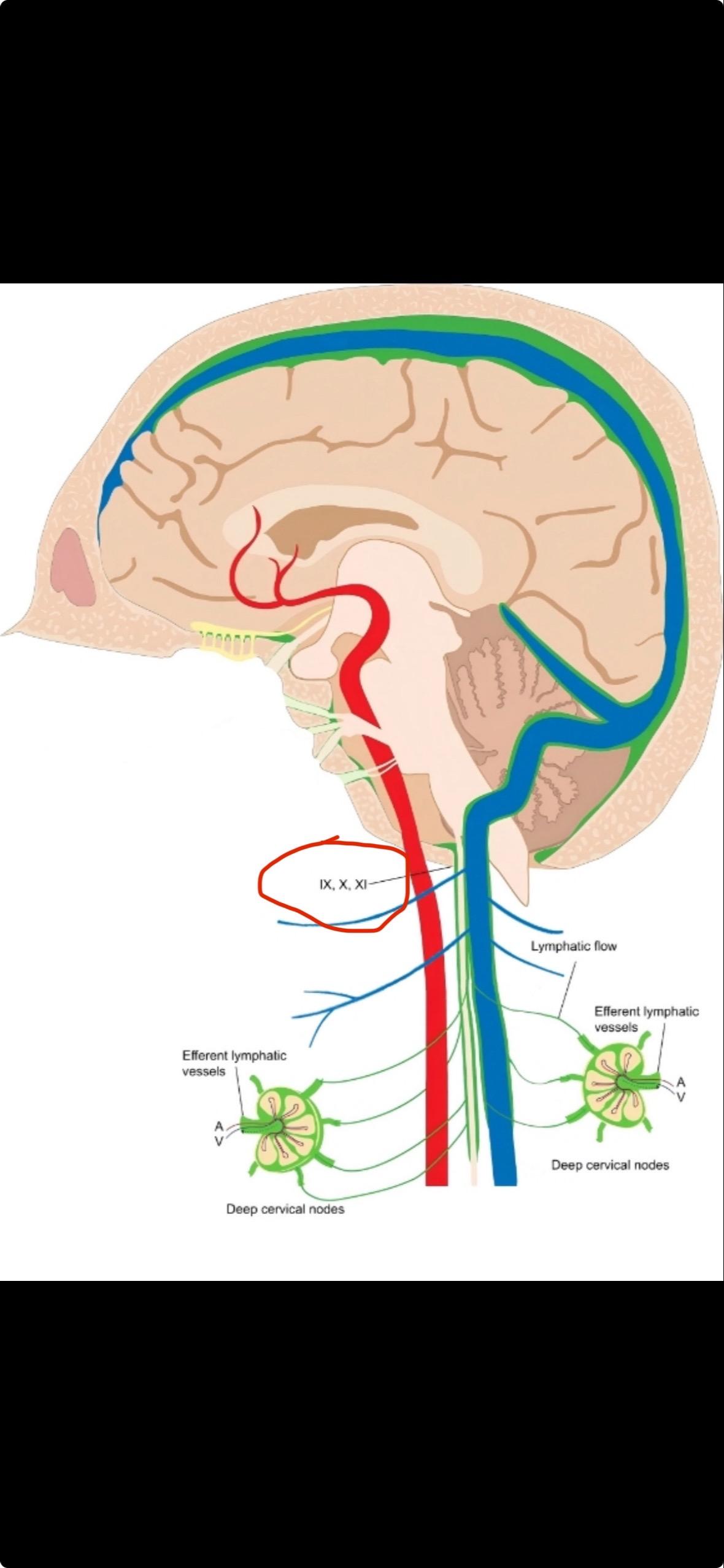 阿尔兹海默病手术-颈深淋巴静脉吻合。客观看待，术前还是要严格评估，不是...