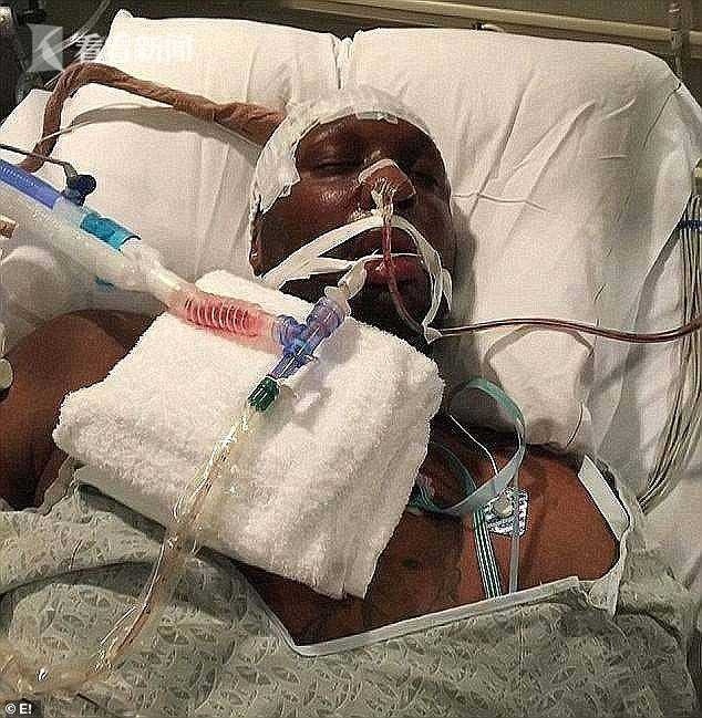 【奥多姆谈吸毒昏迷：中风了12次 以为自己没了 】今日前NBA球员拉马尔·奥多姆