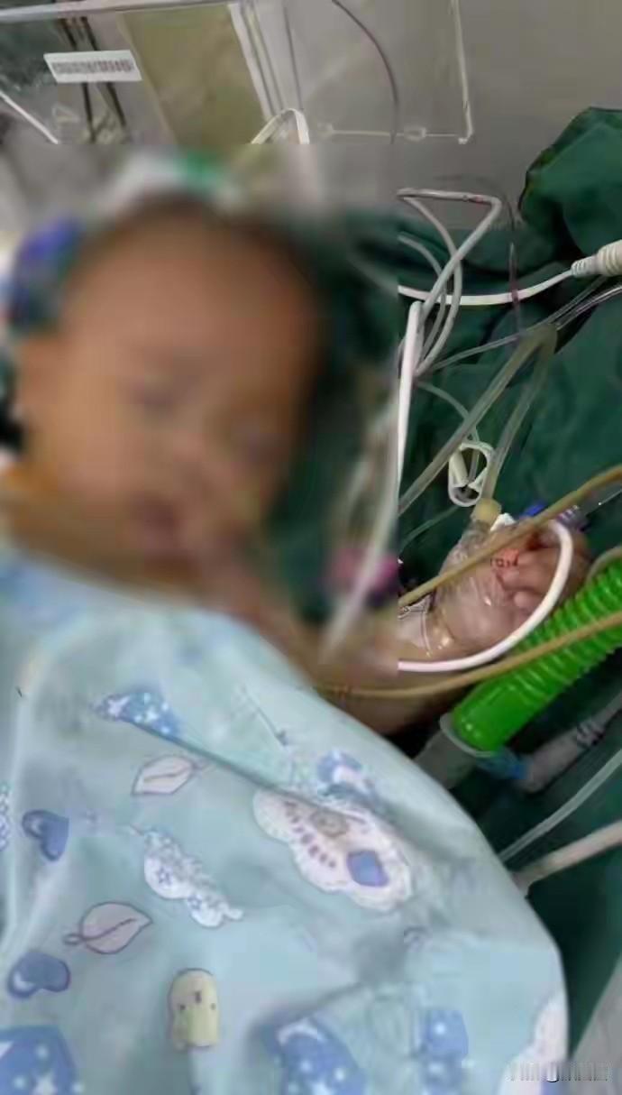 5个月大的宝宝做完心脏手术就走了，眼角还挂着泪，这场手术到底哪儿出问题了？
宁波