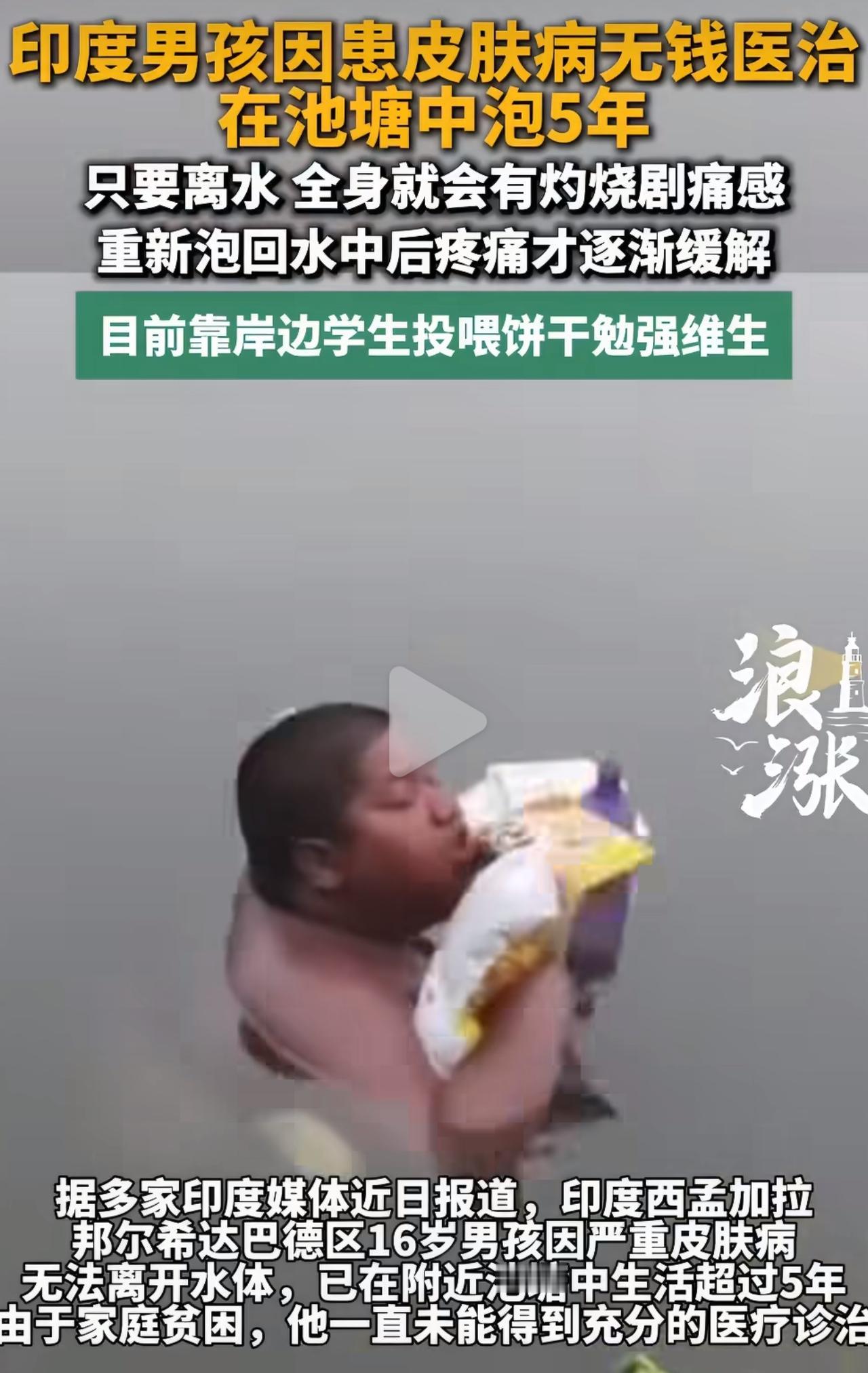 印度少年伊克巴尔患上一种罕见怪病，身体痛苦没人能懂。
只要从水里出来，全身就像被