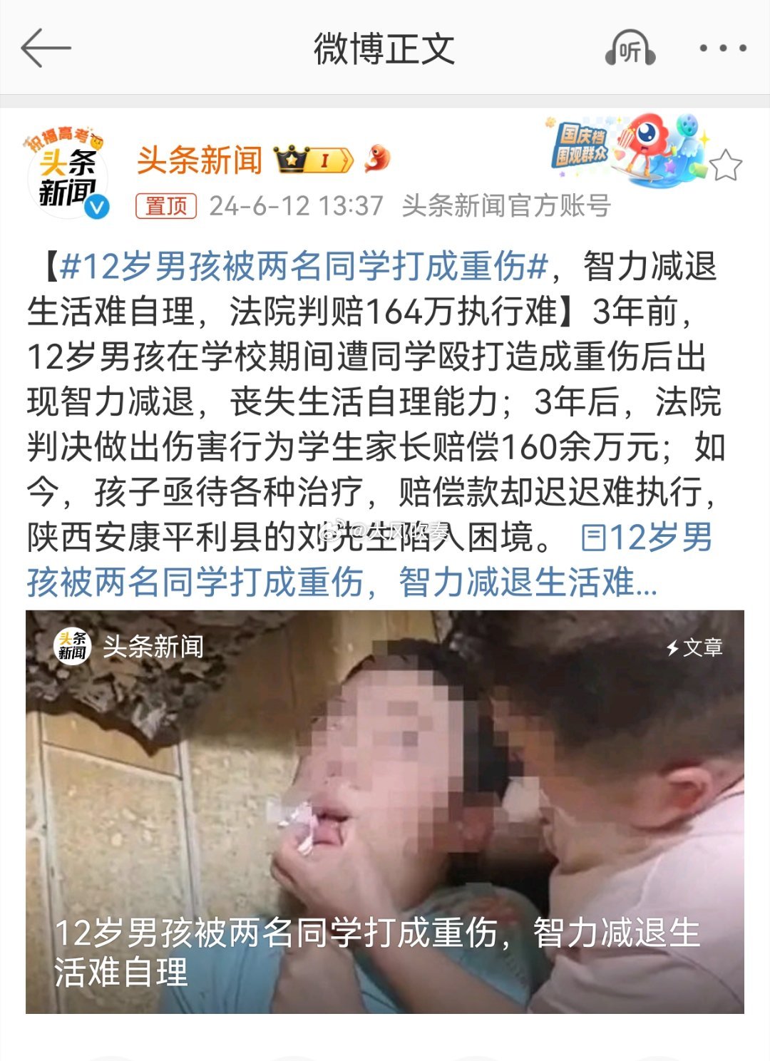 #12岁男孩被两名同学打成重伤#重伤二级，伤残鉴定一个二级一个四级，真的是伤的非