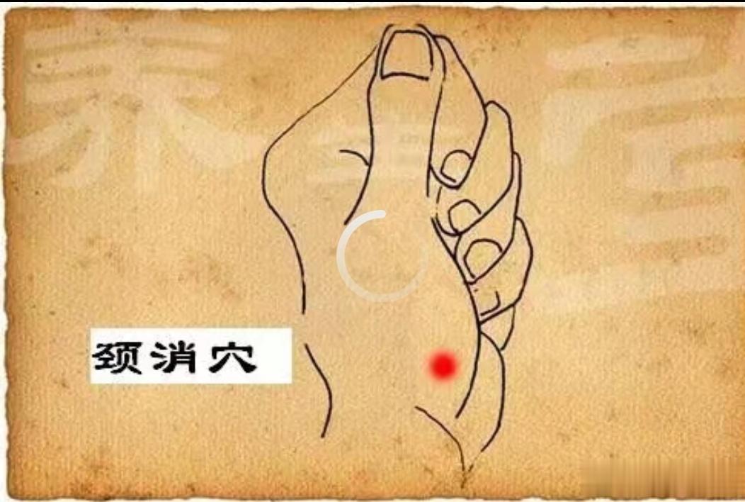  第一个是颈消穴。以指代针，把手伸开，找颈消穴，颈消穴是经验穴（书上没有的穴）。