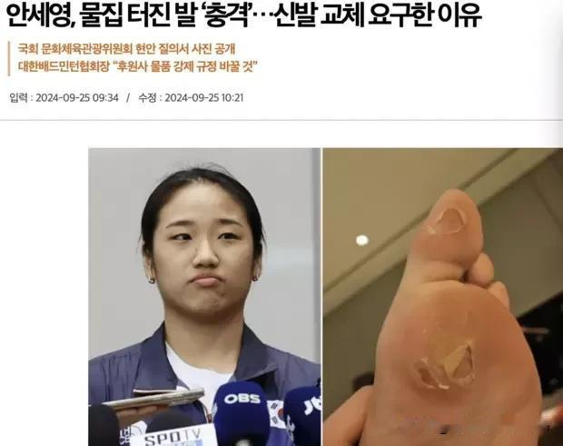 【韩国羽毛球协会强制运动员必须全面采用赞助商的装备被曝光】韩国羽毛球女单奥运金牌