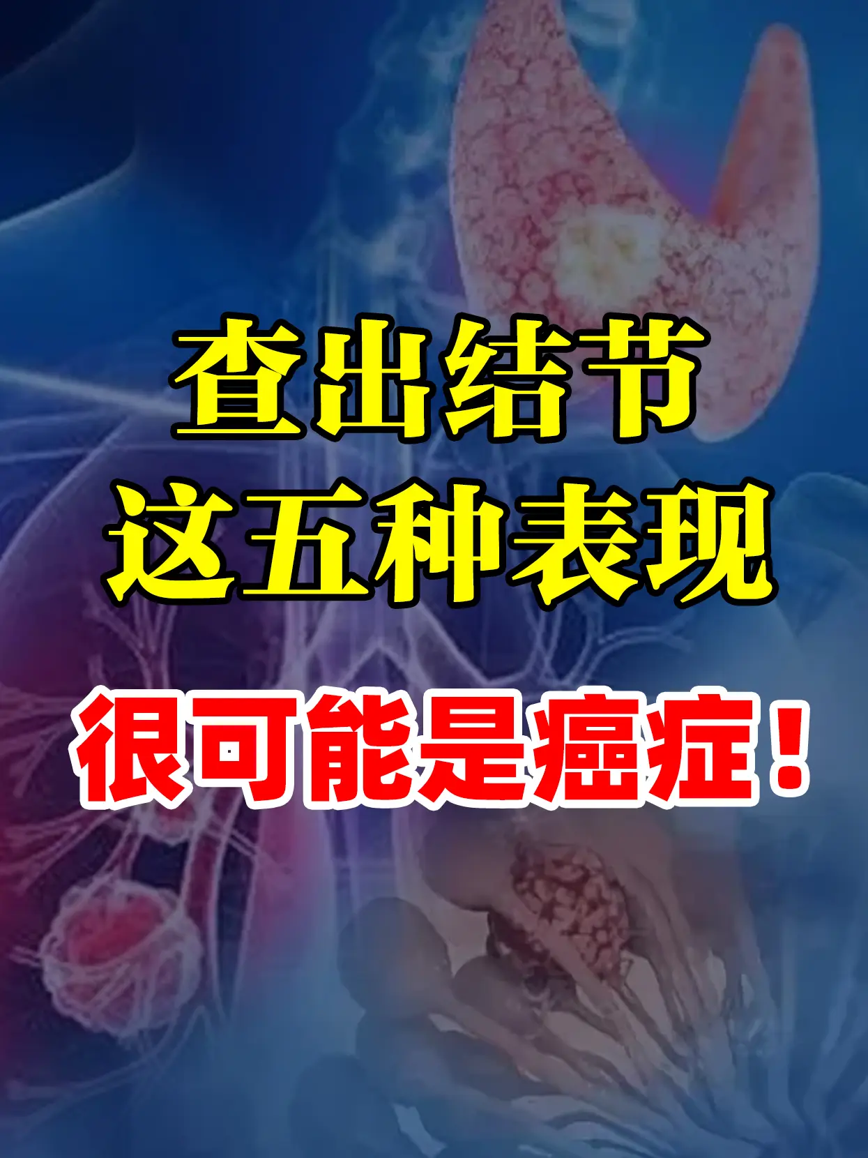 肺结节这几点非常可能是癌症，任何一种都要警惕。  大家好，我是韩世明...