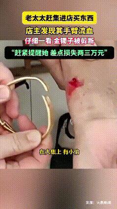 “太缺德了！”山东威海，一老太太去赶集，走进一家店铺时被老板叫住，原来是老太太胳