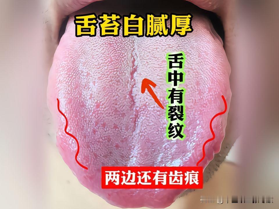 门诊大哥32岁，阳痿早泄患者，被困扰3年有余，一直不好意思来医院[捂脸][捂脸]