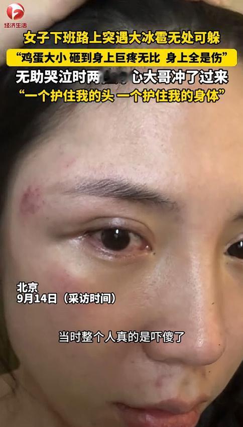 惊险！北京，一女子下班回家，突然遇上罕见的冰雹，根本无处可躲，鸡蛋般大小的冰雹砸