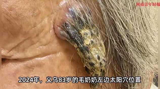 [微风]“活久见！”浙江义乌83岁的陈老太有个习惯，天好时总爱搬个小马扎在门口晒