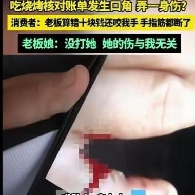 烧烤店账单229元实收239，
女子回去讨要10块钱差价，
结果手指筋被老板娘咬