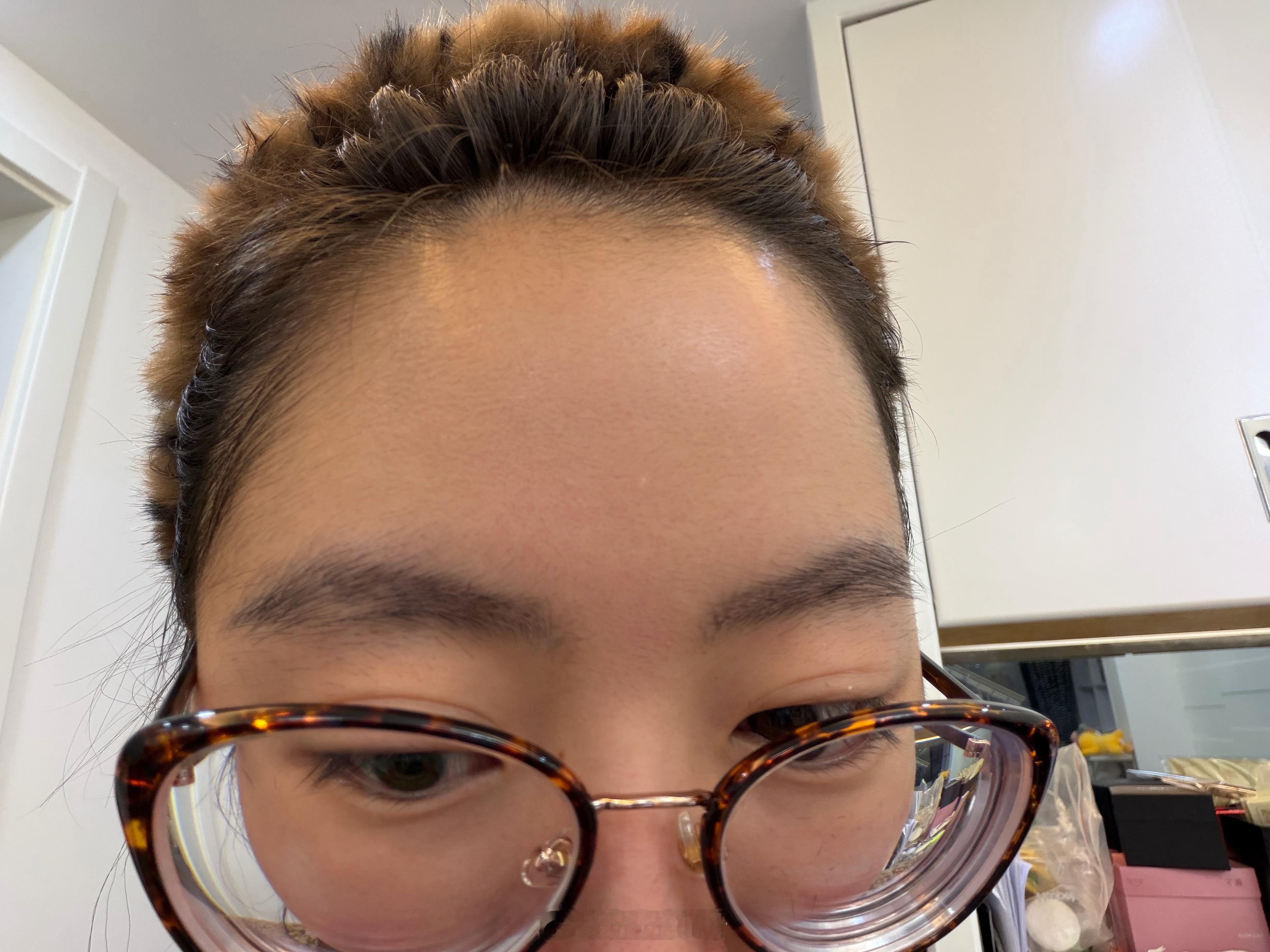 怎么办 眉毛修缺了