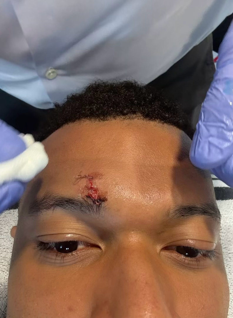 四年了第一次离他这么近是因为手术缝针我服了 