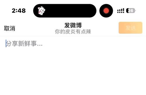 金善禹  猪妈妈都去设置这个灵动岛呀好可爱(๑•̀ω•́๑)♡ 