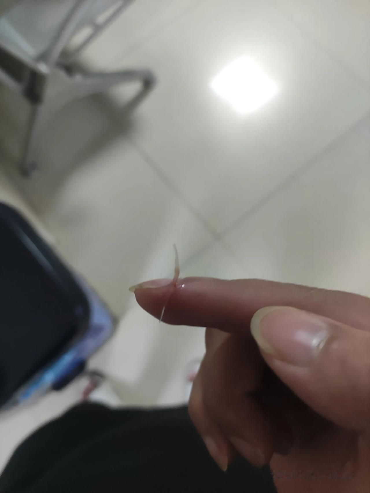 大鱼刺卡喉咙，肉眼看喉咙，已经看不到鱼刺了，卡得很深，最后做喉镜取出来的，从鼻子