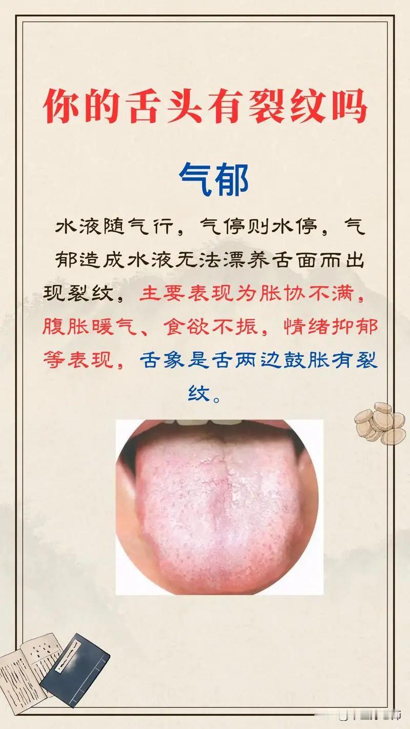 你的舌头有裂纹吗？看看是不是这些症状#健康##舌象分析#