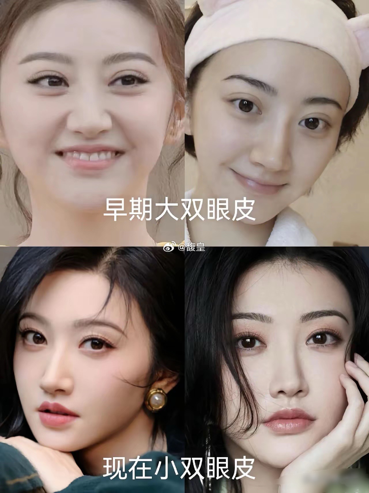 景甜早期悲伤蛙的大双眼皮真的耽误颜值，还好后面调回来了！ ​​​