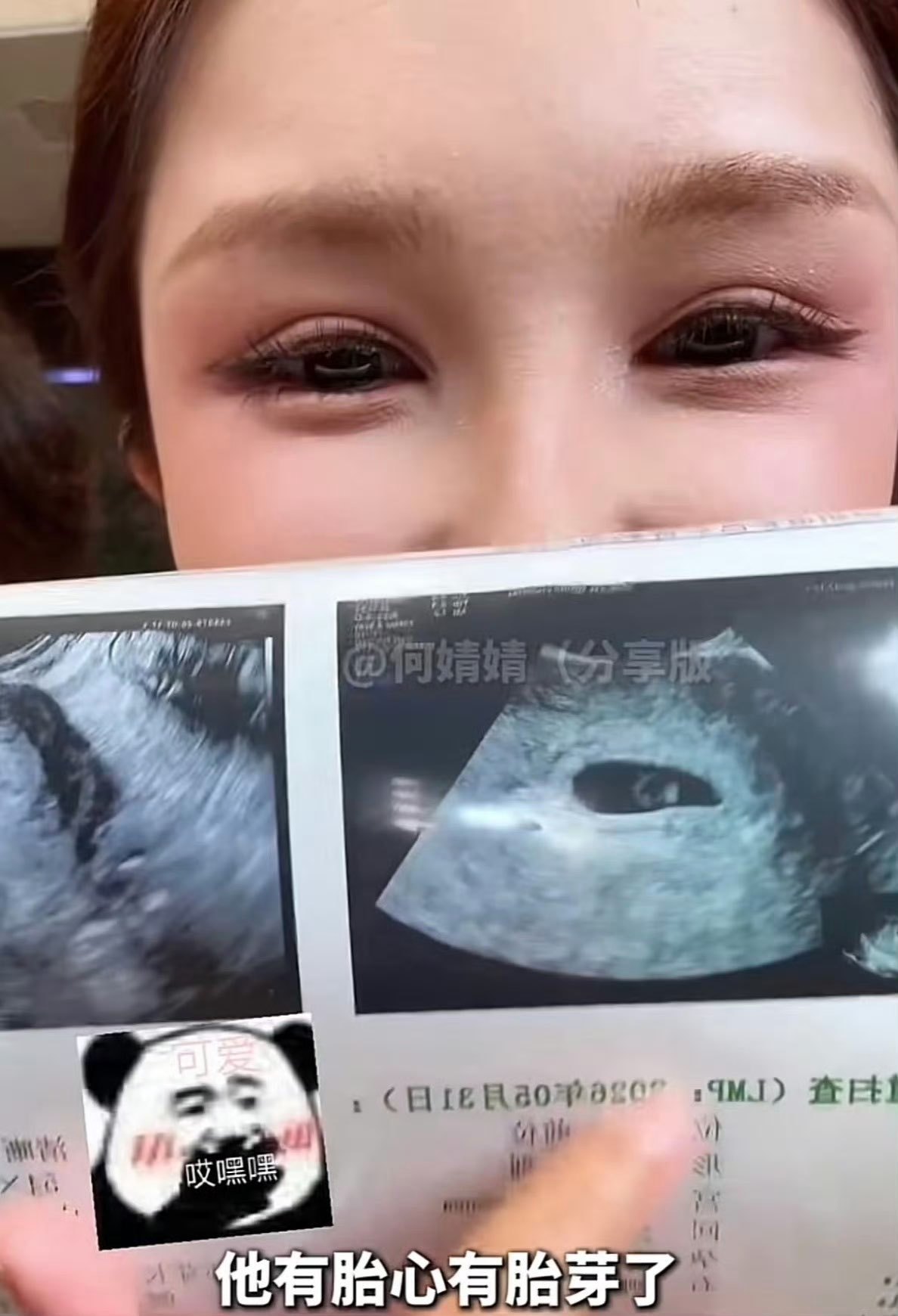 何婧婧流产有些人真是闲得慌，人家孩子没了，你第一反应是“炒作”？那是条生命，不是