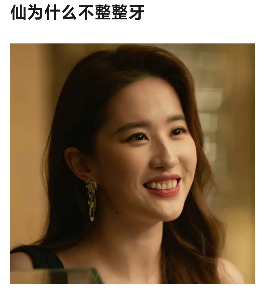 #刘亦菲是历史上首届金鹰女神#刘亦菲为什么不整整牙？ ​​​