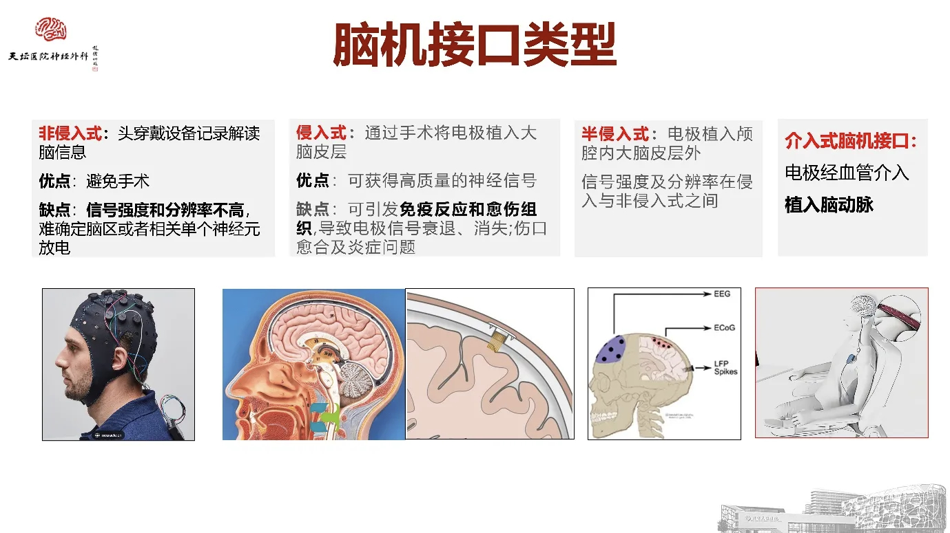 【什么是脑机接口？】随着科技发展，脑机接口逐渐出现在我们的面前。关于脑机接口，综