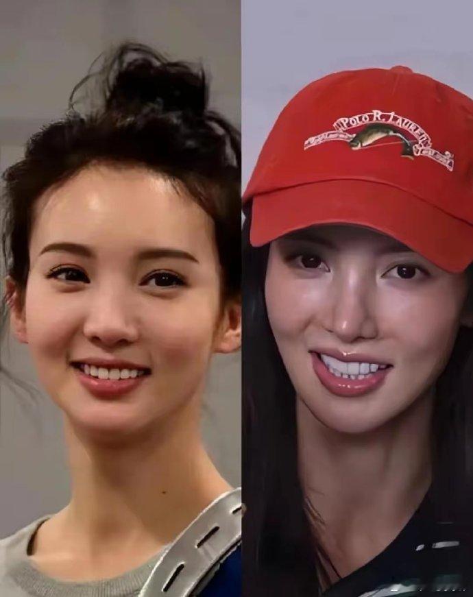 金晨以前嘴也不歪，而且又自然灵动 ​​​