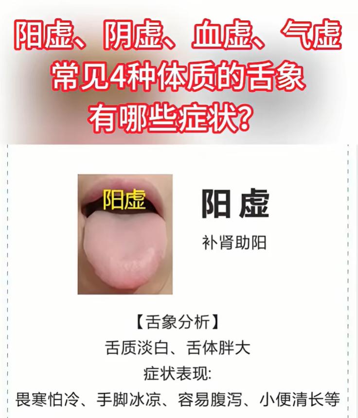 四类亏虚体质舌象科普，学会简单分辨体质