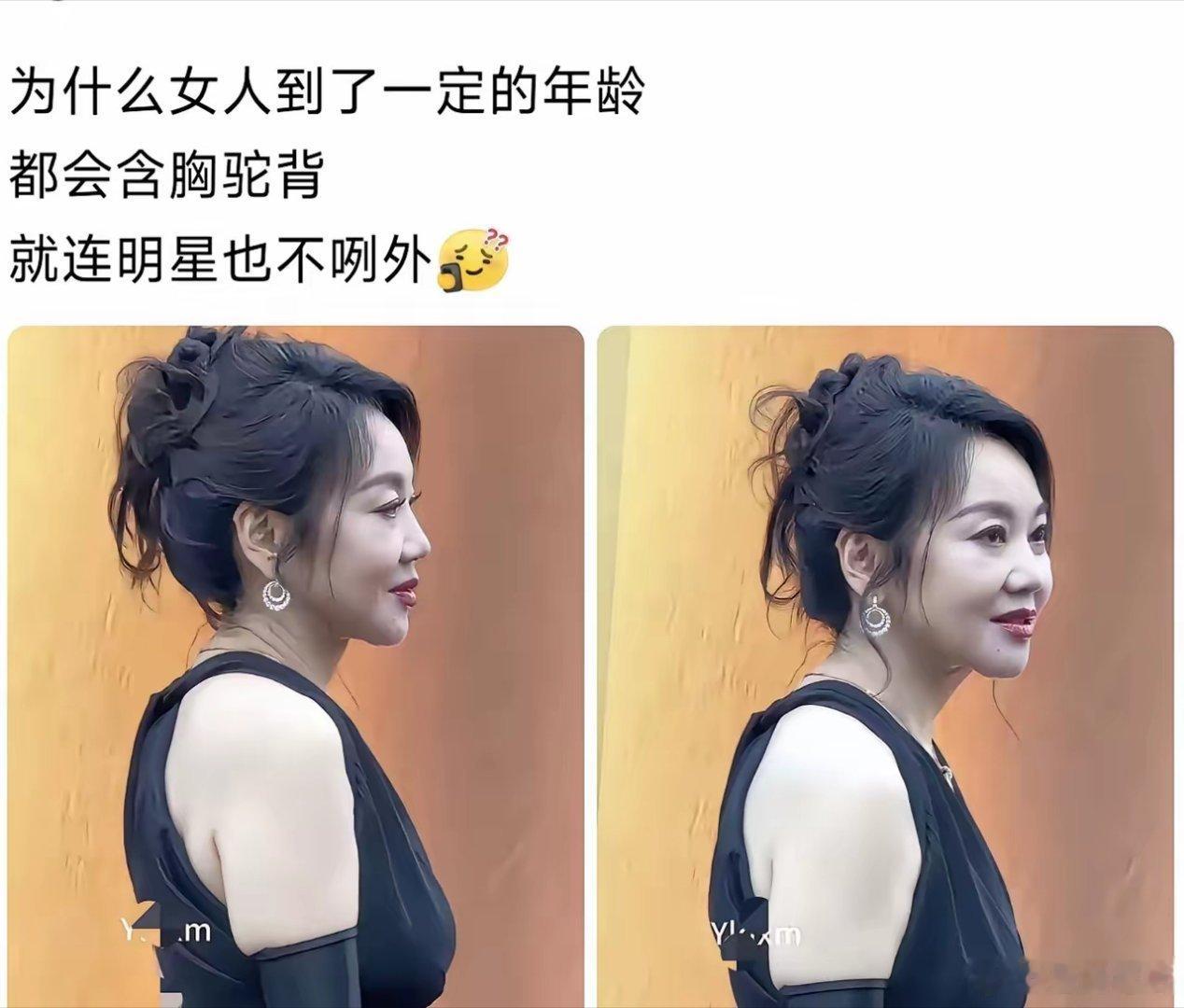 为什么女明星老了也含胸驼背的 